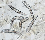 ectoparasitos