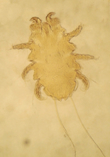 ectoparasitos