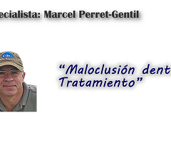 Maloclusión dental: Tratamiento