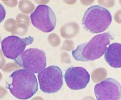 Demostrada la relación de dos oncogenes con la frecuencia de leucemias en ratones