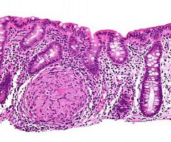 Cambios en los ciclos de luz alteran las defensas intestinales de los ratones