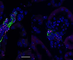 Un receptor olfativo puede explicar la diferencia de tensión arterial en hombres y mujeres